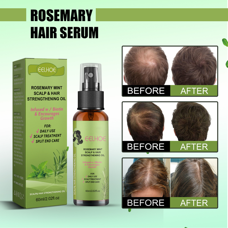 Rosemary Dense Moisturizes Roots, Increases Elasticity, Restores Gloss, and Prevents Hair Loss spray_voghion.com