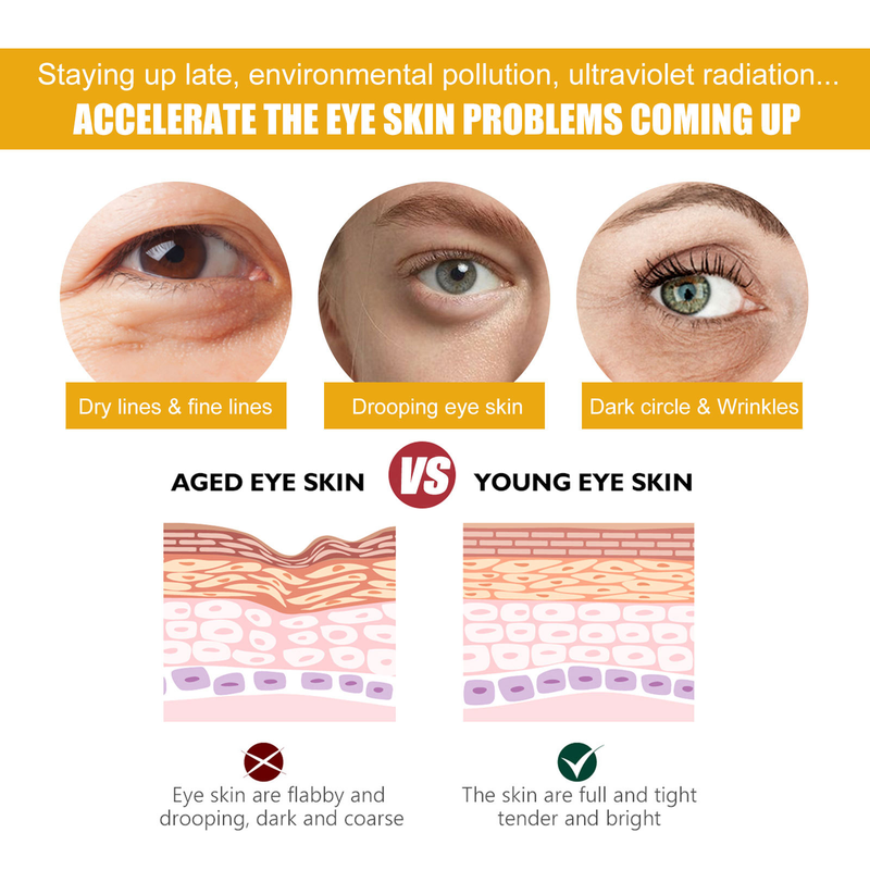Kurkuma Eye Beautiful Cream reduziert feine Linien und dunkle Ringe um die Augen, entfernt Tränensäcke, bekämpft Falten, s,_voghion.com