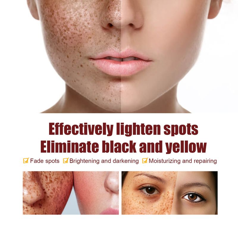 EELHOE Whitening Spotting Cream Spotting, Softening And Moisturizing Care, Brightening Skin Tone_voghion.com