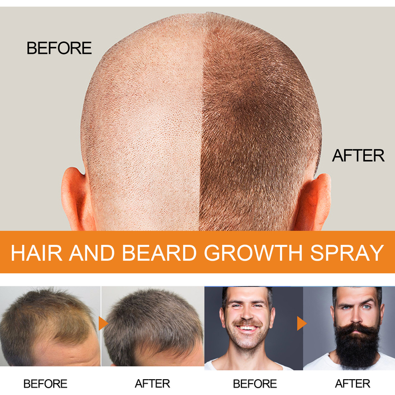 Jayswing Growth spray Men's Beard Dense Care Fluid Toughening Hair Quality Prevention_voghion.com