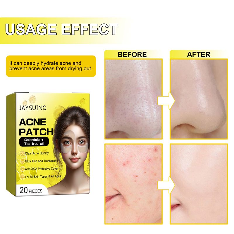 Jaysuing Acne Hydrocolloid Patch For Cleansing Facial Acne, Closing Mouth And Removing Blackheads Delicate Skin Patch_voghion.com