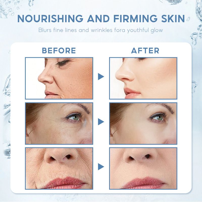 English Sumax Pure Package Hyaluronic Acid face cream 30ml_voghion.com