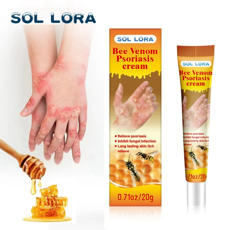 SOL LORA Be Venom Relieving Itching Repairing Hand and Foot Moss Skin Repair Cream_voghion.com