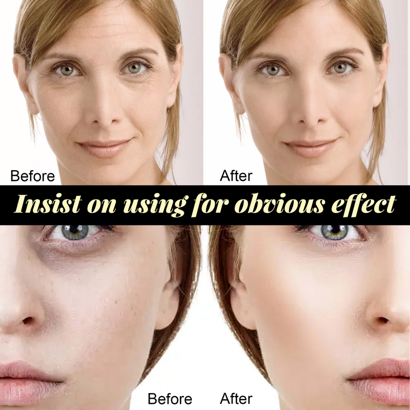 Protein Lifting Thread Kit Face Lift Plump Silk Protein Line Carving Anti Aging Firming Fade Fine Wrinkle Serum Skin Care Female_voghion.com
