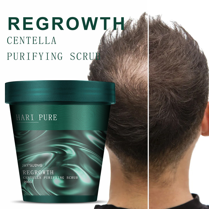 Jaysuing Snow Grass Scrub Cream Saç Temizleme, kepek giderme, kaşıntı giderme, saç derisi bakımı ve büyüme öncesi_voghion.com
