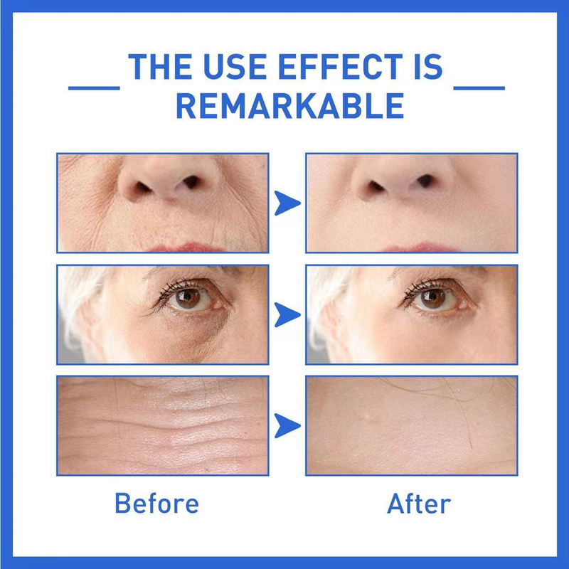 SOL LORA Anti Wrinkle Original Liquid can light fine lines black spots, moisture, tender skin, and prevent aging session_voghion.com