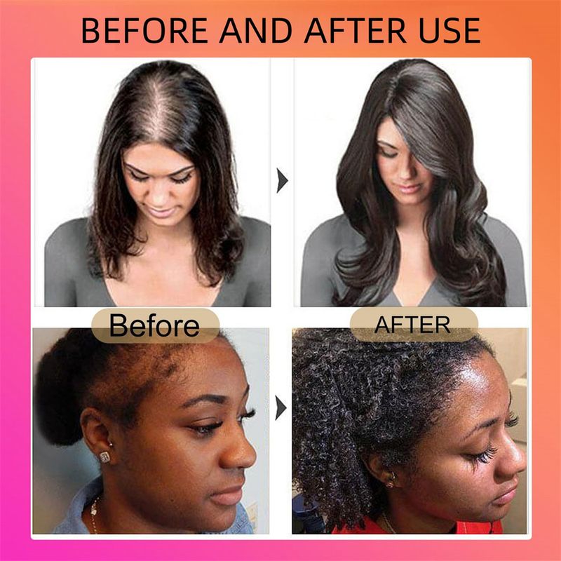 Batana Hair Oil Promotes Hair Growth_voghion.com