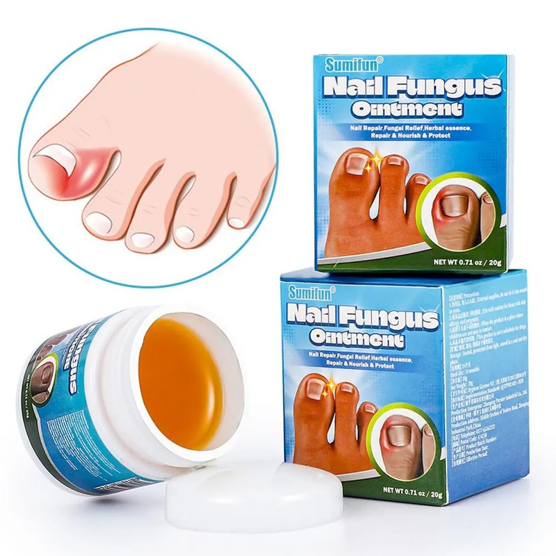 Nagelreparaturserum Salbe Onychomykose Paronychie Nagel Kräuter Zehennagel Fußreparatur Essenz Pflege Reparatur Trockenriss Fußpflege 20g_voghion.com