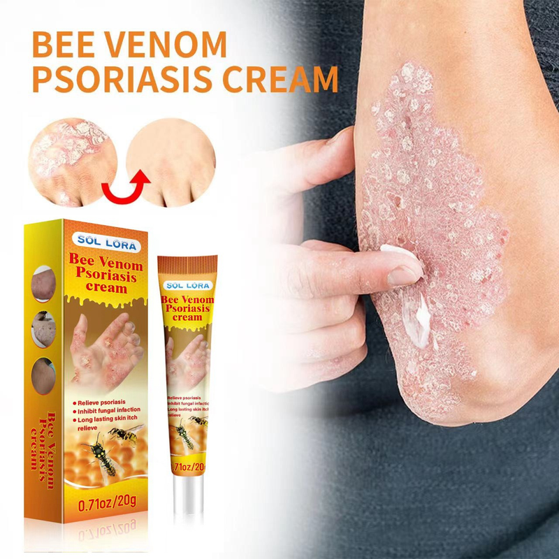 SOL LORA Be Venom Relieving Itching Repairing Hand and Foot Moss Skin Repair Cream_voghion.com