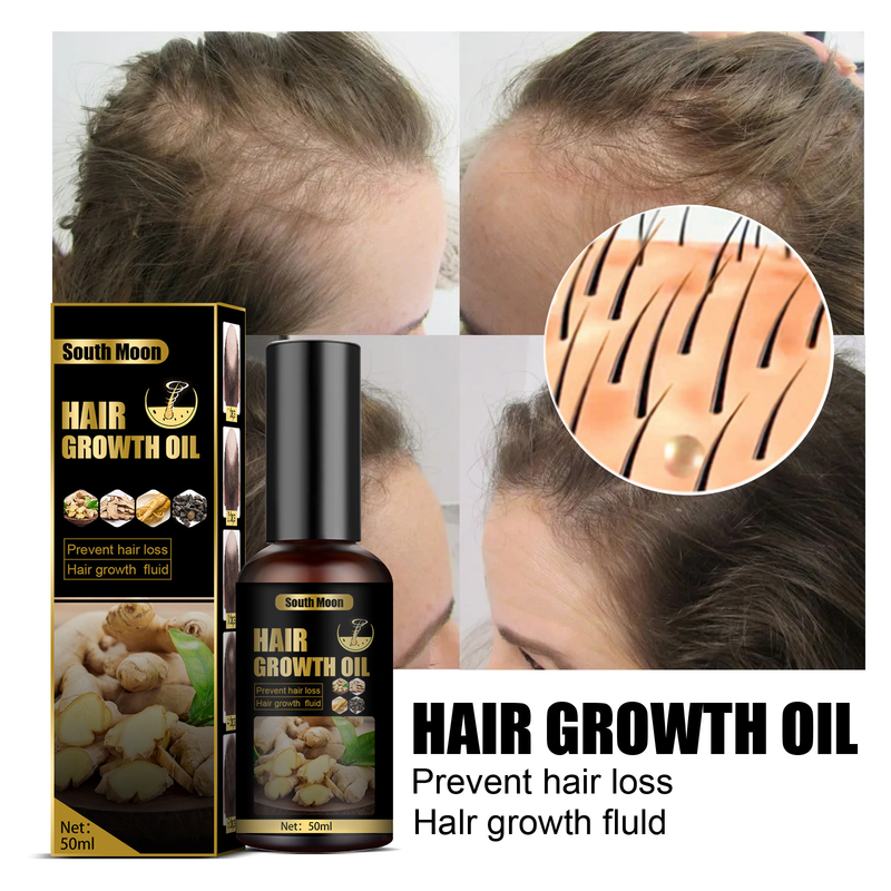 South Moon fertilitet spray anti förlust lotion hår näring tillväxt agent essens_voghion.com
