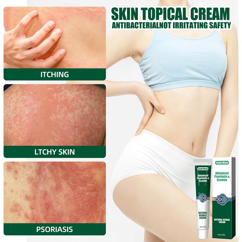 South Moon Skin Topical Cream Moisturizing and Moisturizing, Reducing Itching Herbal Ointment_voghion.com
