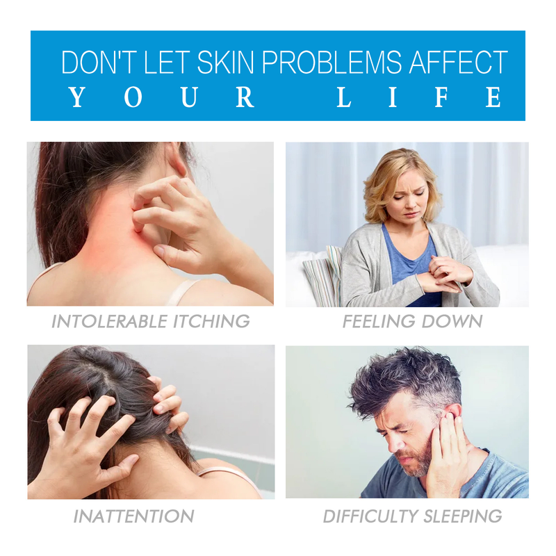B12 Güzel Vitamin Kremi Cilt Kızarıklığını, Kaşıntıyı Giderir, Kaşıntı Önleyici, Cildi Onarır, İnek Derisi Yosun Bakım Kremi,_voghion.com