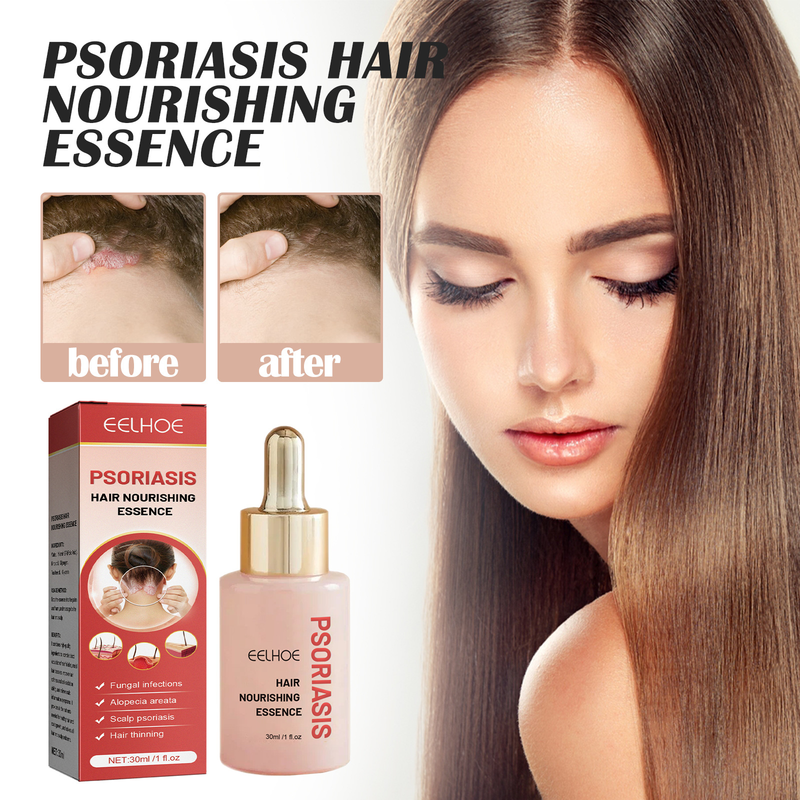 EELHOE Bovine Skin Moss Nourishing essence Deep Cleansing Scalp Removing Scurf Antipruritic Refreshing Dense H_voghion.com