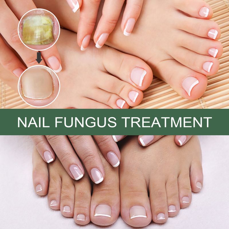 2025 Hand And Foot Nail Nutritional Cleaning Care Liquid_voghion.com