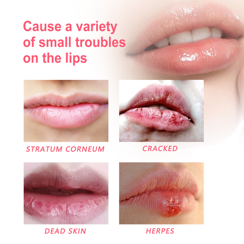 Care Beautiful Lip Oil Moisturizes, Moisturizes, Repairs Lip Dead Skin, Prevents Dry Cracks, and Gently Care Lip Oil_voghion.com