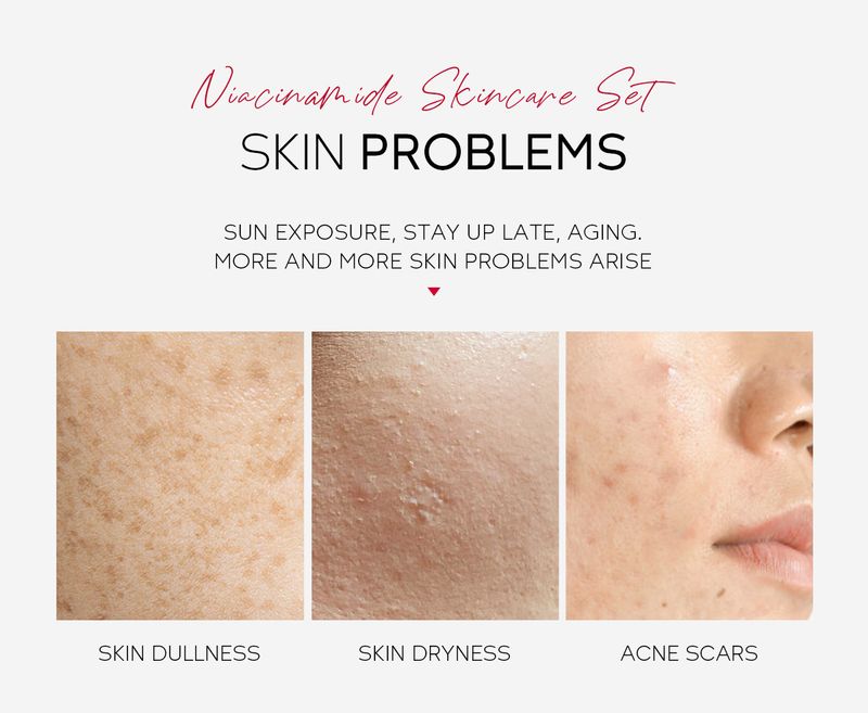 Sets LAIKOU Pro Niacinamide 3 Piece Facial Care Set Hydrating And Moisturizing_voghion.com