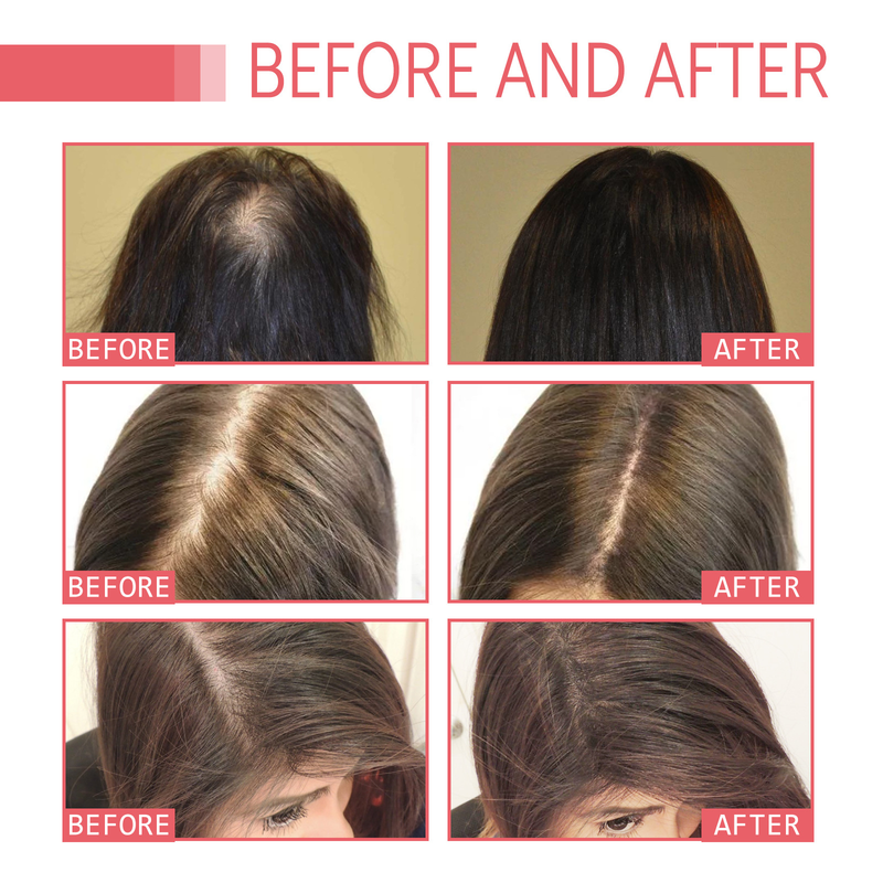 2024 Dense E Moisturizes Roots, Repairs Dry Fury Hair, Prevents Hair Loss and Fixation new_voghion.com