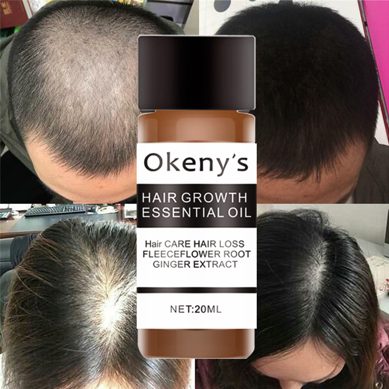 Okeny's Fast Powerful Hair Growth Essence Products Αιθέριο έλαιο Υγρό Θεραπεία Πρόληψης Τριχόπτωσης Περιποίηση μαλλιών Andrea 20ml_voghion.com