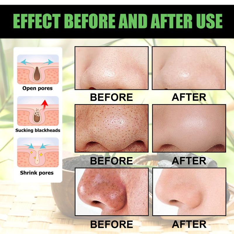 EELHOE Bamboo Charcoal Blackhead Removal Mask, Deep Cleanse Pores And Acne T-Zone Oil Control With A Peel Mask_voghion.com