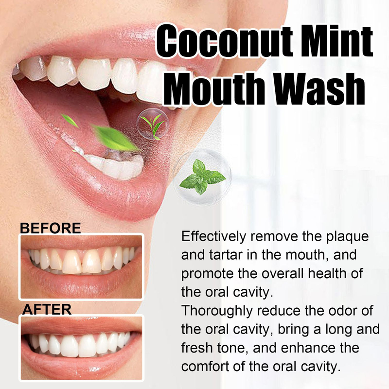 Oralhoe Coconut Mint Mouth Wash, Whitening Teeth Yellow Teeth Stains Tongue Coating Clean Fresh Breath Oral Care_voghion.com