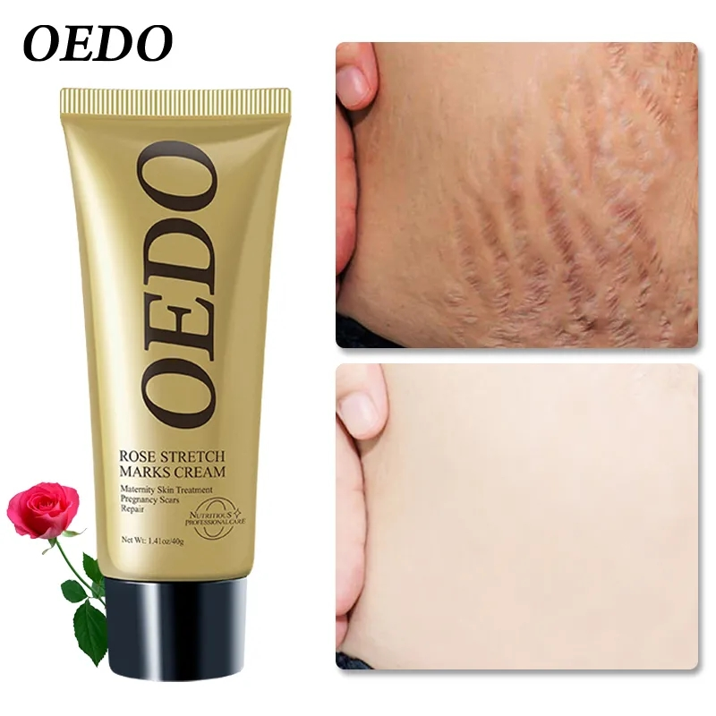 Rose Removes Stretch Mark Cream To Remove Postpartum Obesity Pregnant Women Repair Anti-Aging Anti-Winkles Firming Body Cream_voghion.com