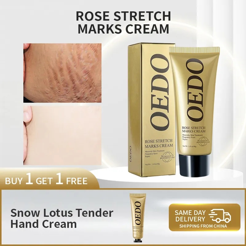 Rose Removes Stretch Mark Cream To Remove Postpartum Obesity Pregnant Women Repair Anti-Aging Anti-Winkles Firming Body Cream_voghion.com