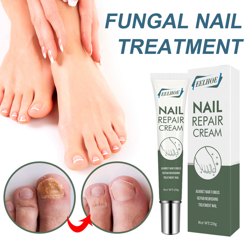 Eelhoe Fast removing polish repair care ointment Thickening nail cream gel_voghion.com