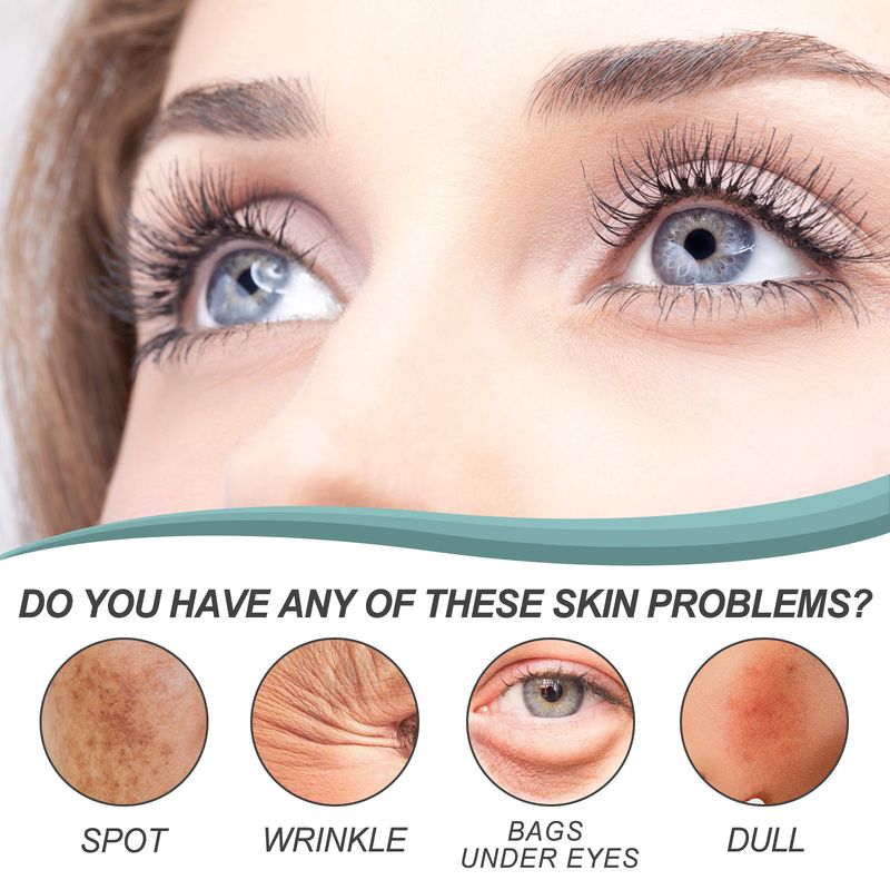 EELHOE Crema per la correzione delle macchie nere Idratante, Idratante Schiarente Macchie della pelle Melanina Ringiovanente, Illuminante_voghion.com