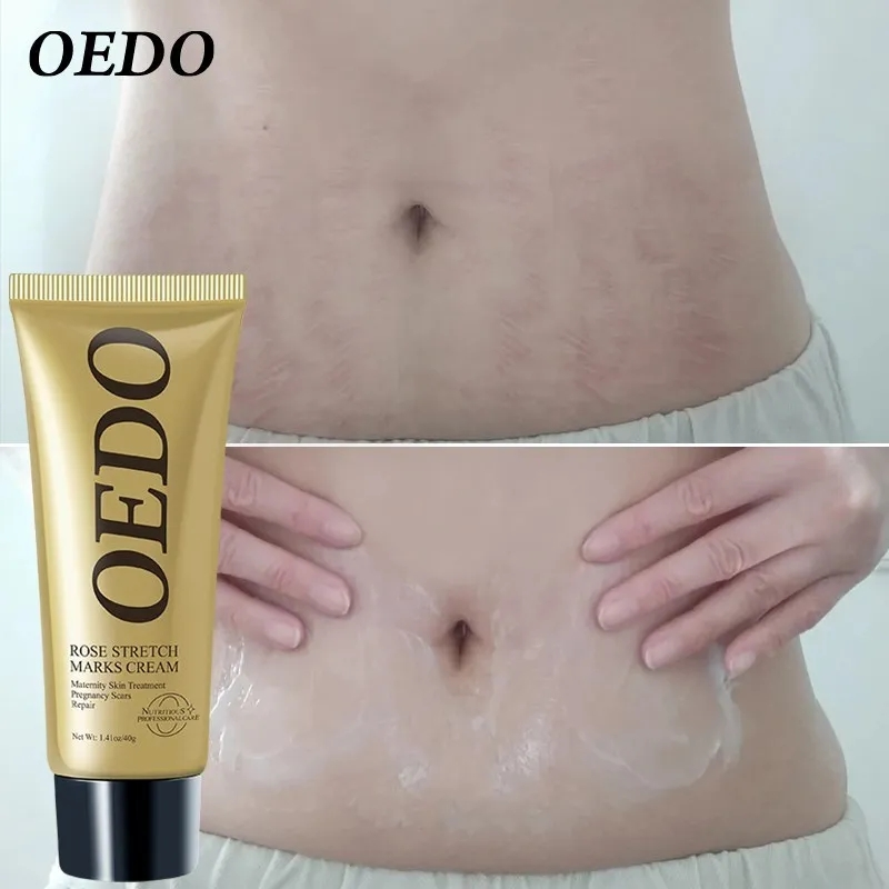 Rose Removes Stretch Mark Cream To Remove Postpartum Obesity Pregnant Women Repair Anti-Aging Anti-Winkles Firming Body Cream_voghion.com