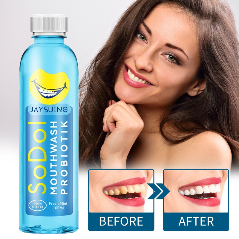 für Jaysuing Mundwasser, das Zahnflecken entfernt, Gerüche beseitigt und die Mundgesundheit frisch erhält, Oral Cleanli_voghion.com