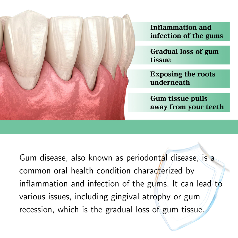 South Moon Gum Repair Drops Gum Care and Periodontal Blistering Oral Cleansing Care Drops_voghion.com