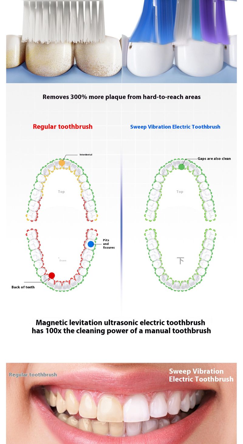 Elektrische Zahnbürste – 5 Modi, 40.000 U/min, USB-C-Aufladung, IPX7 wasserdicht (3 Bürstenköpfe, Weiß/Blau/Pink)_voghion.com
