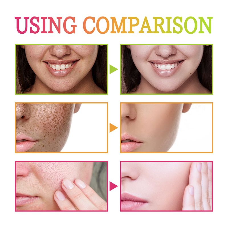 EELHOE Ginger Vitamin C Facial Essence Reduces Dark Spots, Fine Lines, Contracts Pores, Brightens Skin Tone, Moisturizes And Moisturizes_voghion.com