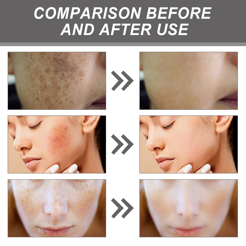 OUHOE essence softens cutin repair facial dullness fade black spot and whiten skin_voghion.com