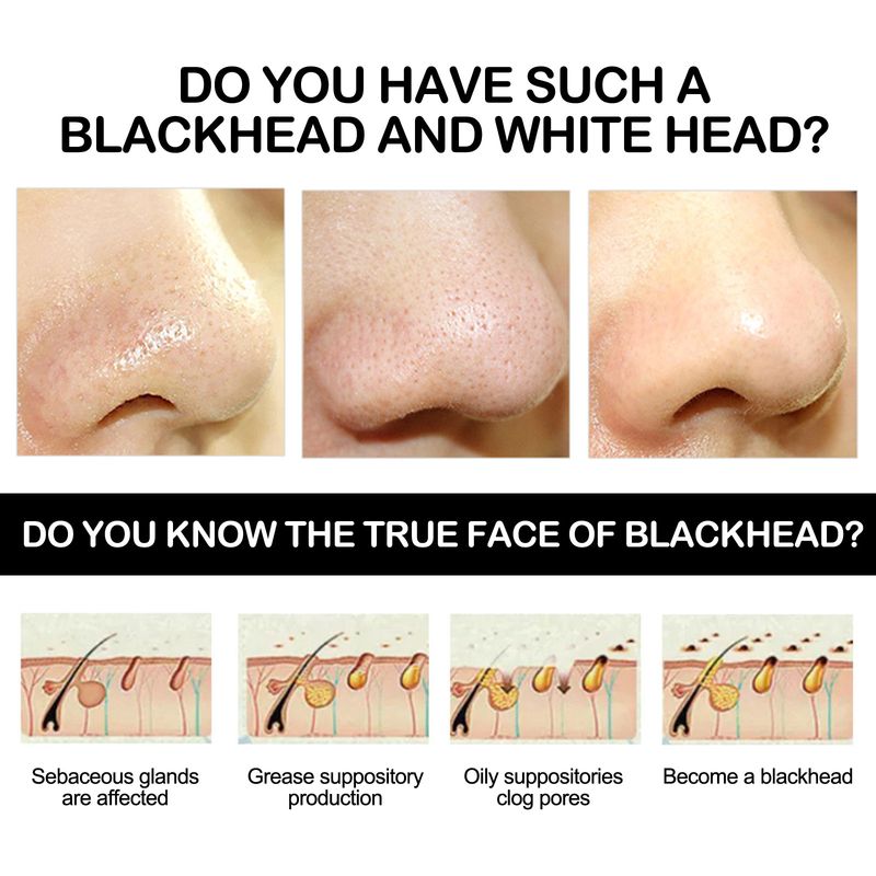 Crème pour enlever les points noirs du nez, bandes nasales exfoliantes, nettoyage en profondeur, rétrécissement des pores, points noirs du nez, autocollants pour enlever les points noirs, soins de la peau, maquillage_voghion.com