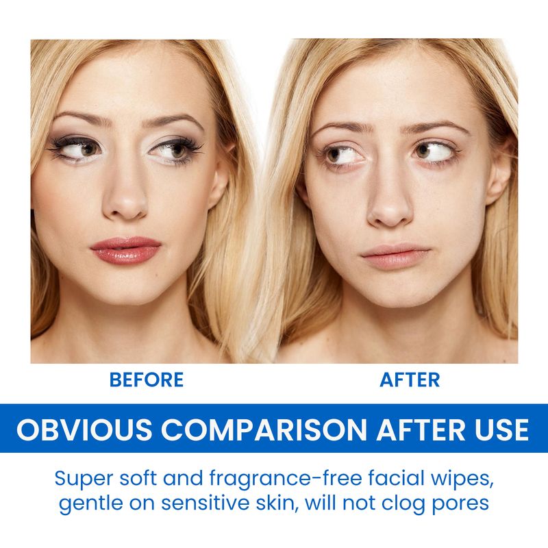 EELHOE Gentle Makeup Remover Wipes Deep Cleanse Face Eye And Lip Makeup Gentle Refreshing Non-Irritating Makeup Remover Wipes_voghion.com