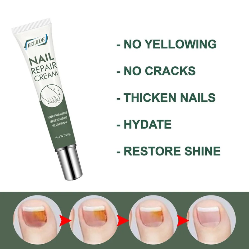 Repair Cream Rapid Removal of Grey Nail Repair Nail Care Ointment Thickening Soft Nail Cream Gel Foot Care Callus Remover_voghion.com
