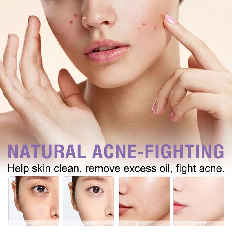 Ximonth Lavender Cleansing Soap Cleanses Facial Skin With Oil Control For Pores And Acne Moisturizing Cleanser_voghion.com