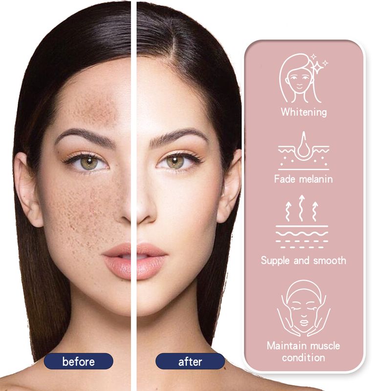 Crema schiarente Hoygi Skin Genesis Spot Whitening Cream, diluire le macchie, pelle liscia e colore bianco brillante. Questa delicata crema idratante per la pelle._voghion.com