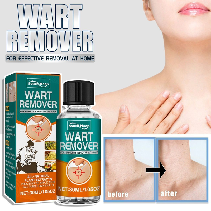 Remover, 24ss skin removal, removal of flesh thorns, flat skin, especially hand foot calluses, and chicken eye ,_voghion.com