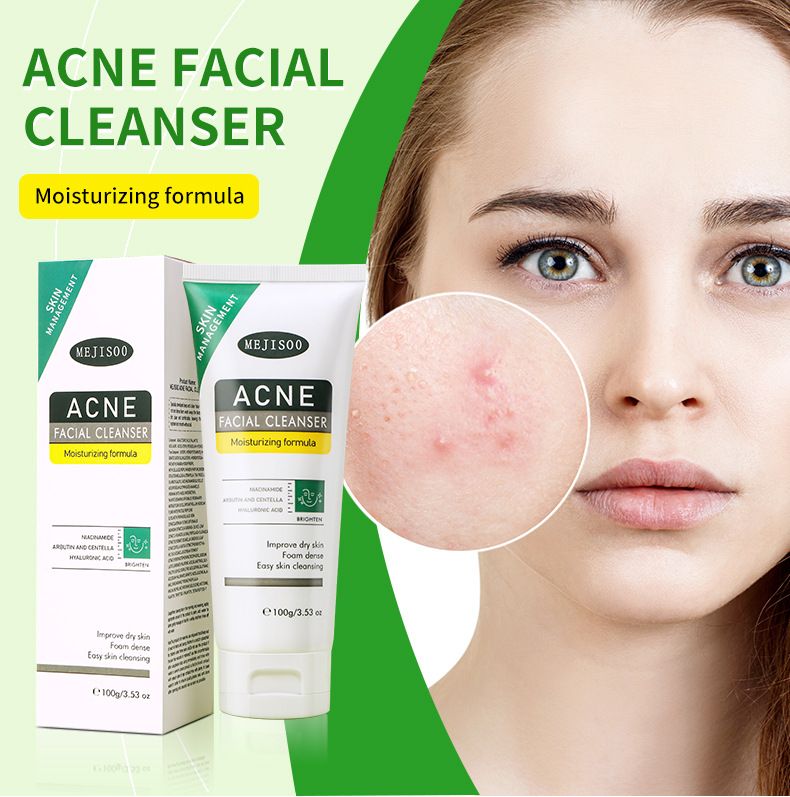 Detergenti DETERGENTE VISO PER ACNE Detergente per acne Detergente idratante Prodotti per la cura della pelle_voghion.com