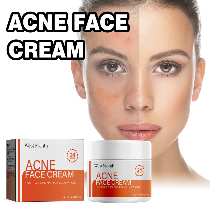 L'acido salicilico di West&Month maschera delicata, pulisce, schiarisce i segni dell'acne, rassoda i pori e pulisce il viso_voghion.com