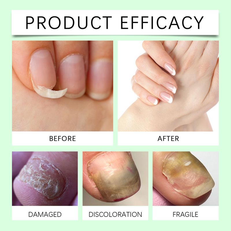 Solution de soin des ongles Oceaura, hydratante douce, nettoyante, anti-gerçures, exfoliante, hydratante et nourrissante pour les mains et les pieds_voghion.com