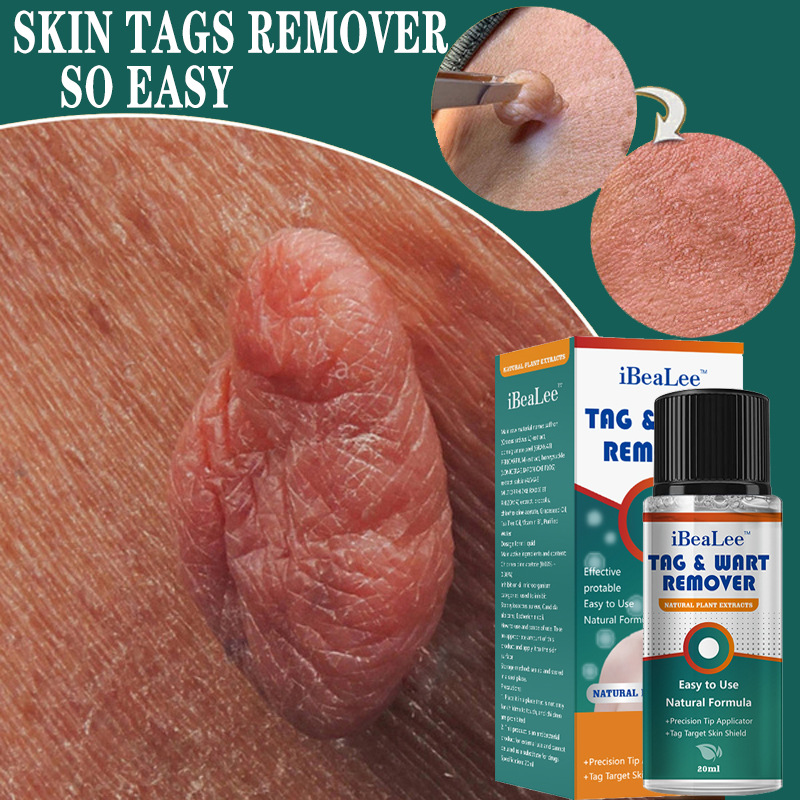 Verrues Shuowuxin, IBeaLee verrues particulièrement plates et pointues, liquide chaud et hydratant pour l'élimination des verrues du visage_voghion.com
