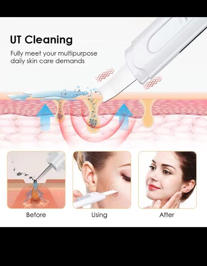 Elektrischer Hautwäscher, Gesichts-Mitesserentferner, Tiefenreinigungs- und Liftmaschine für das Gesicht._voghion.com
