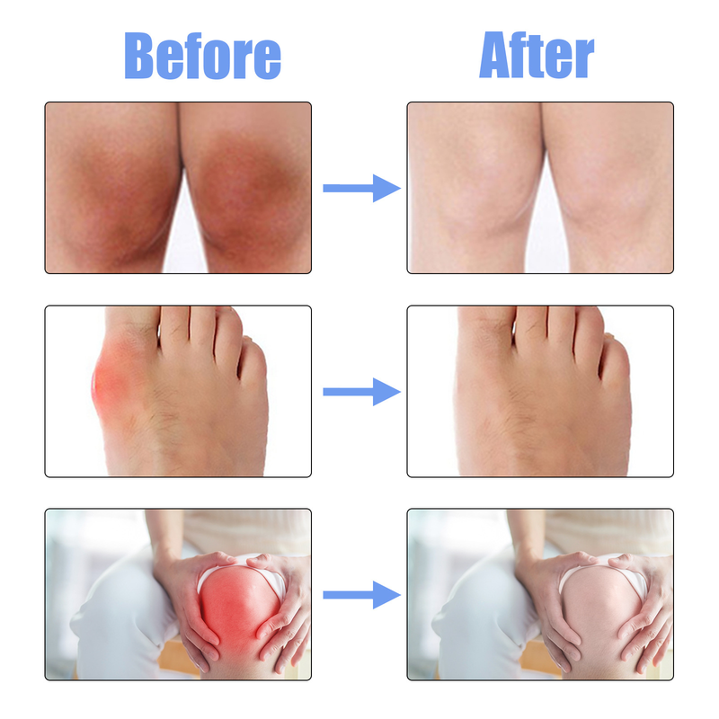 Joint Repair spray to Relieve Pain Thumb Capsule of Wrist and Knee Curved Joints 2024_voghion.com