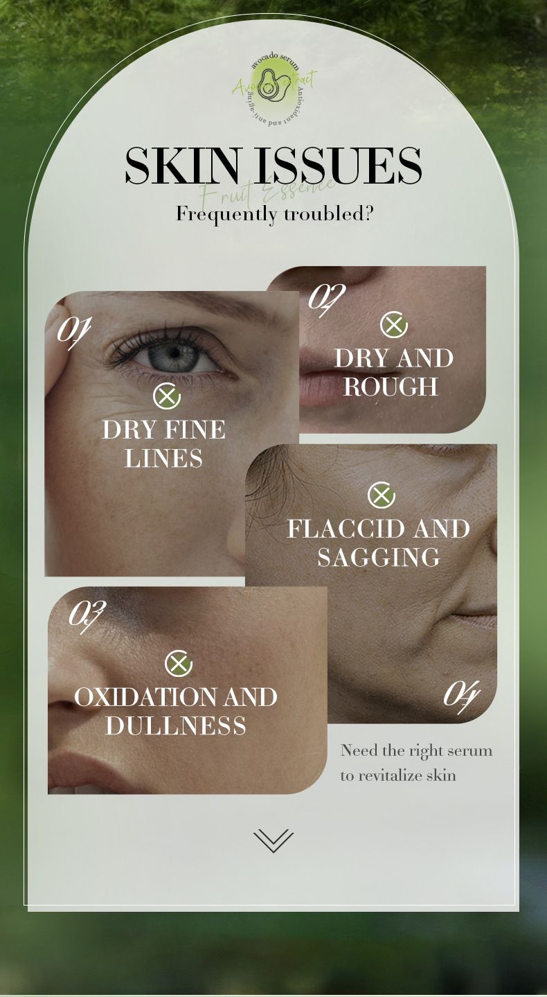 SADOER Strawberry Fruit Milk Serum 30ml Moisturizing And Smooth Skin Tender Brightening Moisturizing And Hydrating Serum_voghion.com