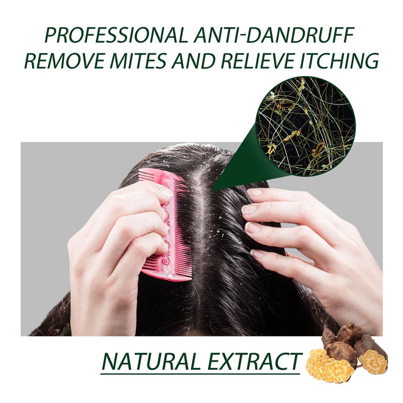 South Moon Head Moss Anti Itching Shampoo for scalp cleaning, dandruff removal, hair oil itching control, refreshing and_voghion.com