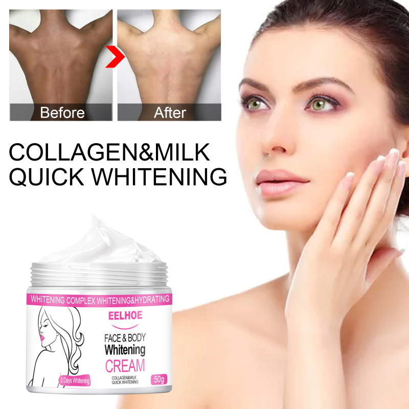 Bleken Gezichtsverlichting Onderarm Oksel Whitening Cream Benen Knieën Geslachtsdelen Lichaam_voghion.com