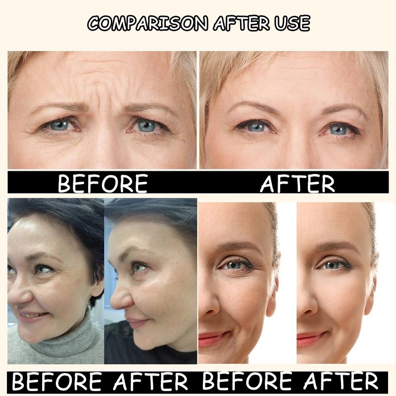 Hoygi Facial Essence Is A Gentle And Moisturizing Serum That Makes The Face Radiant And Rejuvenates The Skin_voghion.com